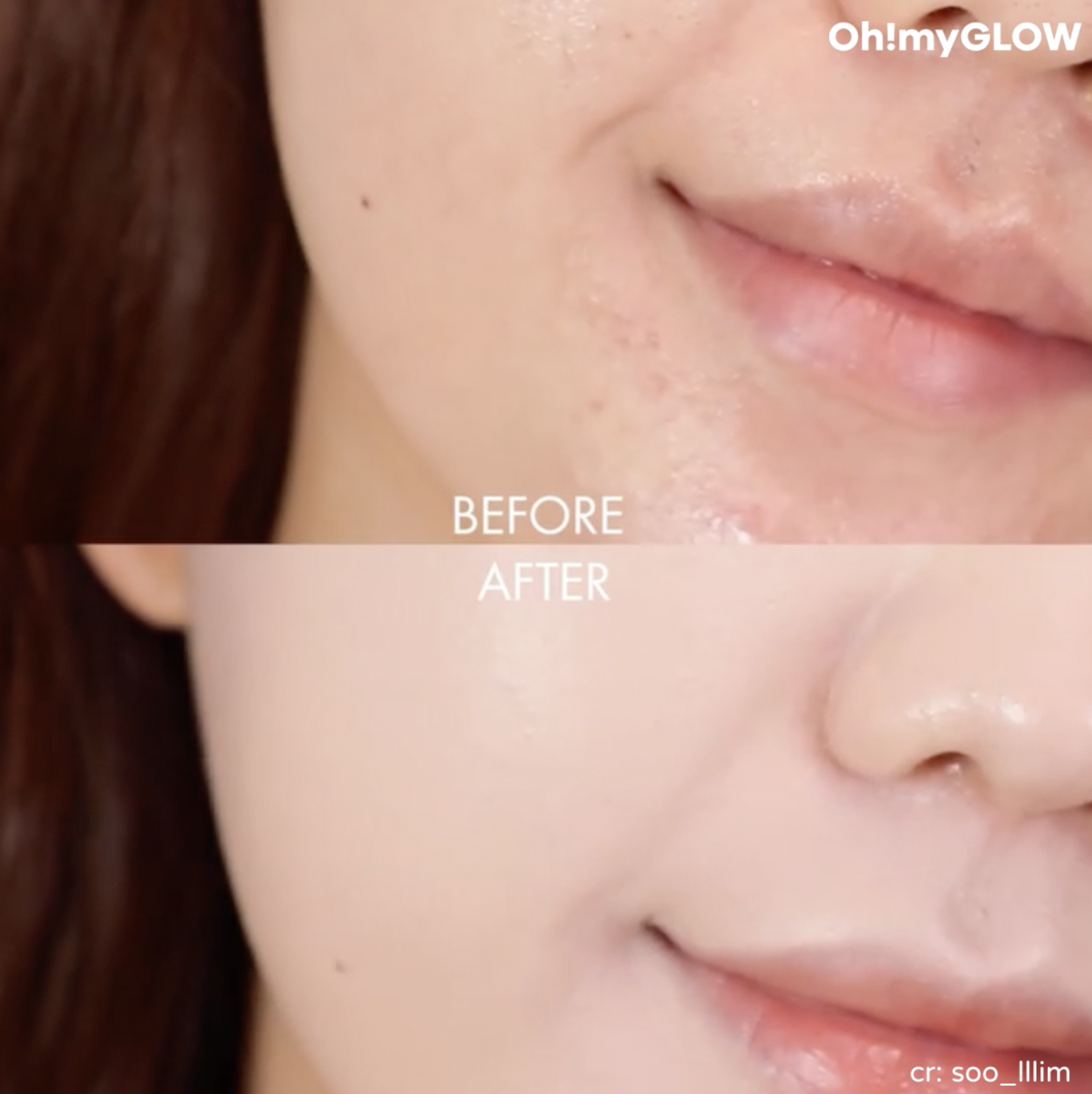 Before and After