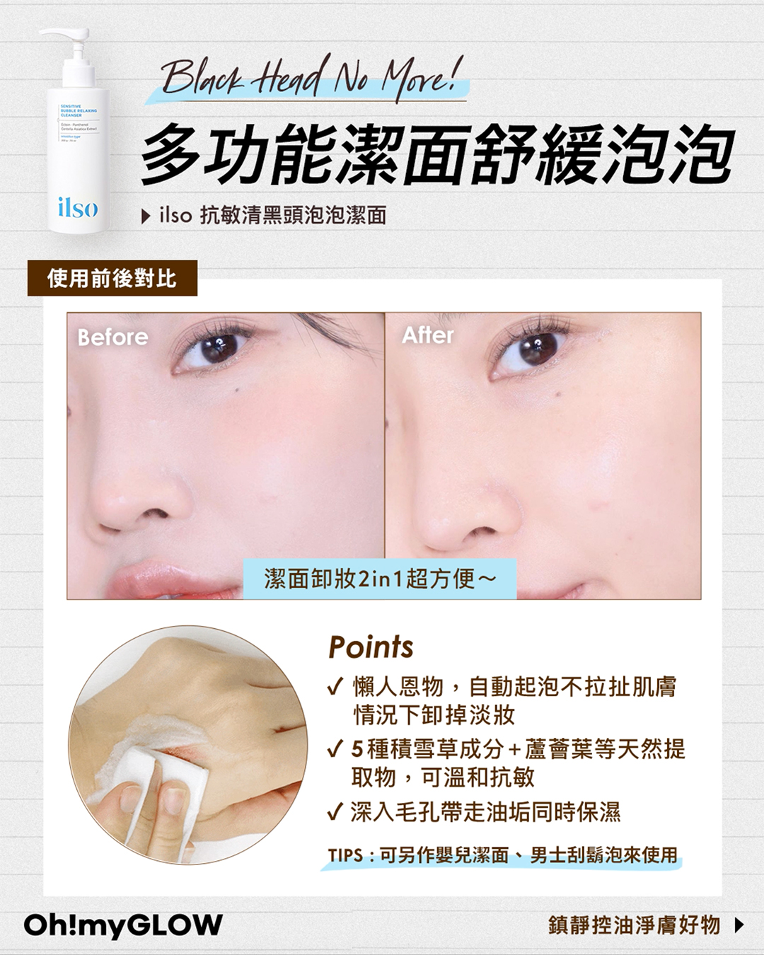 🟢𝗶𝗹𝘀𝗼 𝗦𝗲𝗻𝘀𝗶𝘁𝗶𝘃𝗲 𝗕𝘂𝗯𝗯𝗹𝗲 𝗥𝗲𝗹𝗮𝘅𝗶𝗻𝗴 𝗖𝗹𝗲𝗮𝗻𝘀𝗲𝗿 潔面泡泡