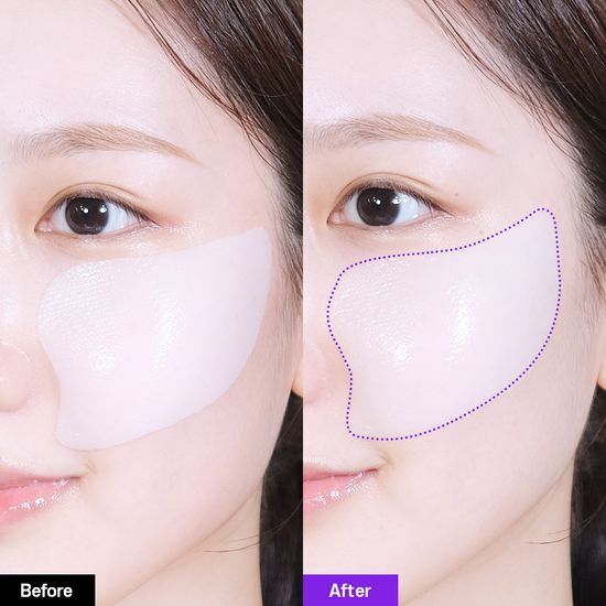 韓國黑科技 醫美級無痛緊緻提拉！BioHeal BOH x Oligio Probioderm 3D Lifting Voluming Patch 益生菌3D提拉抗老高彈性凝膠面頰面膜 4+1P - 5片裝
