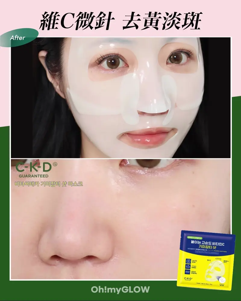 【買4送1】2週淡斑~韓國 CKD Vita C Teca Blemish Shot Mask 99%高純度維C淡斑抗皺微針果凍面膜 - 2種選擇